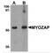Myocardial Zonula Adherens Protein antibody, MBS151319, MyBioSource, Western Blot image 