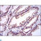 Ubiquitin Conjugating Enzyme E2 I antibody, LS-C814043, Lifespan Biosciences, Immunohistochemistry paraffin image 