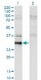 BAF Chromatin Remodeling Complex Subunit BCL7B antibody, H00009275-M02, Novus Biologicals, Western Blot image 
