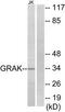 Granzyme K antibody, TA313992, Origene, Western Blot image 