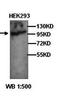 Beta-defensin 131 antibody, orb77244, Biorbyt, Western Blot image 