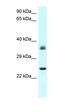 JunD Proto-Oncogene, AP-1 Transcription Factor Subunit antibody, orb329596, Biorbyt, Western Blot image 