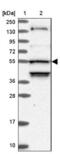 Serine/threonine-protein kinase 38-like antibody, NBP1-92454, Novus Biologicals, Western Blot image 