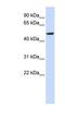 Cytochrome b-561 antibody, NBP1-60118, Novus Biologicals, Western Blot image 