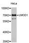 Leiomodin 1 antibody, STJ24416, St John