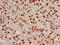 Histone H2B type 1-B antibody, LS-C670401, Lifespan Biosciences, Immunohistochemistry paraffin image 