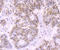 DNA Ligase 4 antibody, A01685-2, Boster Biological Technology, Immunohistochemistry paraffin image 