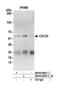 Cell Division Cycle 20 antibody, NB100-59827, Novus Biologicals, Western Blot image 