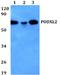 Podocalyxin Like 2 antibody, A11824-1, Boster Biological Technology, Western Blot image 