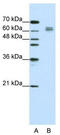 Eukaryotic translation initiation factor 4B antibody, TA345775, Origene, Western Blot image 