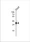HLA class II histocompatibility antigen, DQ beta 1 chain antibody, TA325028, Origene, Western Blot image 
