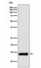 Prokineticin 1 antibody, M05751, Boster Biological Technology, Western Blot image 