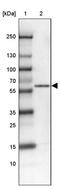 WAS/WASL Interacting Protein Family Member 1 antibody, PA5-51995, Invitrogen Antibodies, Western Blot image 