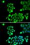 Nei Like DNA Glycosylase 1 antibody, LS-C334322, Lifespan Biosciences, Immunofluorescence image 