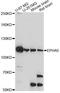 EPH Receptor A5 antibody, A14238, ABclonal Technology, Western Blot image 