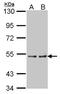 Cytochrome P450 4A11 antibody, NBP1-31427, Novus Biologicals, Western Blot image 