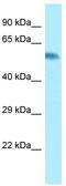 Cytochrome P450 Family 2 Subfamily A Member 6 antibody, TA342853, Origene, Western Blot image 