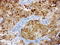 Glucosylceramidase Beta antibody, LS-C796905, Lifespan Biosciences, Immunohistochemistry paraffin image 