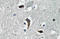 Potassium Calcium-Activated Channel Subfamily M Regulatory Beta Subunit 1 antibody, AP20667PU-N, Origene, Immunohistochemistry paraffin image 