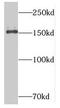 Nuclear pore complex protein Nup153 antibody, FNab05921, FineTest, Western Blot image 