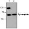 Dystrophin antibody, GTX59790, GeneTex, Western Blot image 