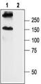 Gamma-Aminobutyric Acid Type B Receptor Subunit 2 antibody, TA328675, Origene, Western Blot image 