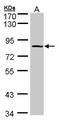 ADAM Metallopeptidase Domain 33 antibody, GTX104804, GeneTex, Western Blot image 