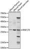 RING finger protein 170 antibody, LS-C750168, Lifespan Biosciences, Western Blot image 