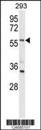 Limb Development Membrane Protein 1 Like antibody, 64-119, ProSci, Western Blot image 