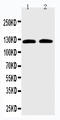 Solute Carrier Family 12 Member 6 antibody, LS-C313277, Lifespan Biosciences, Western Blot image 