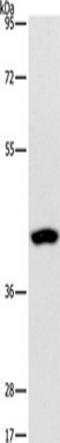 5-Phosphohydroxy-L-Lysine Phospho-Lyase antibody, TA349458, Origene, Western Blot image 