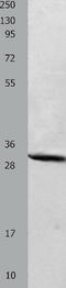 Carbonic anhydrase 2 antibody, TA323747, Origene, Western Blot image 