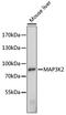 Mitogen-activated protein kinase kinase kinase 2 antibody, 15-896, ProSci, Western Blot image 