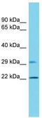 Vacuolar Protein Sorting 25 Homolog antibody, TA342975, Origene, Western Blot image 
