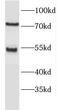 Ectonucleoside Triphosphate Diphosphohydrolase 8 antibody, FNab02788, FineTest, Western Blot image 