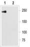 Sodium Voltage-Gated Channel Alpha Subunit 5 antibody, TA328703, Origene, Western Blot image 