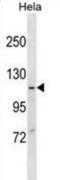 Major Vault Protein antibody, abx025511, Abbexa, Western Blot image 
