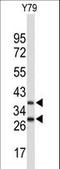 F-Box Protein 4 antibody, LS-C166087, Lifespan Biosciences, Western Blot image 