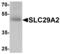 Equilibrative nucleoside transporter 2 antibody, MBS153589, MyBioSource, Western Blot image 