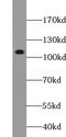 Ubiquitin Specific Peptidase 48 antibody, FNab09337, FineTest, Western Blot image 