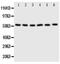 SCL antibody, GTX12283, GeneTex, Western Blot image 