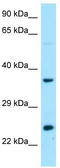 D-Aminoacyl-TRNA Deacylase 1 antibody, TA337929, Origene, Western Blot image 