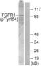 Fibroblast Growth Factor Receptor 1 antibody, LS-C117357, Lifespan Biosciences, Western Blot image 