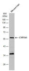 Cytochrome P450 Family 7 Subfamily A Member 1 antibody, GTX108871, GeneTex, Western Blot image 