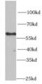Bifunctional polynucleotide phosphatase/kinase antibody, FNab06583, FineTest, Western Blot image 