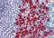 Cell Adhesion Molecule 4 antibody, orb19717, Biorbyt, Immunohistochemistry paraffin image 