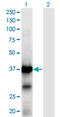 XPA, DNA Damage Recognition And Repair Factor antibody, LS-C198443, Lifespan Biosciences, Western Blot image 