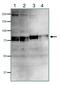 Denticleless E3 Ubiquitin Protein Ligase Homolog antibody, GTX00893, GeneTex, Western Blot image 