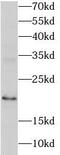 Ribonuclease H2 subunit C antibody, FNab07330, FineTest, Western Blot image 