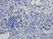 BCL2 antibody, orb10173, Biorbyt, Immunohistochemistry paraffin image 